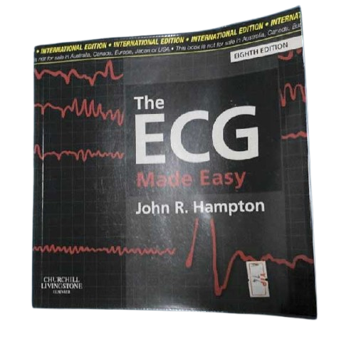 ECG Made Easy